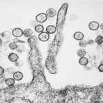 Black-and-white micrograph showing many round cells clustered around ribbon-like filaments on a rough surface, resembling microscopic bacteria on a textured substrate.